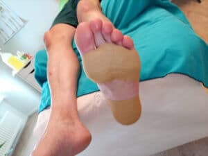 Getapte voet van een wandelaar op de massagetafel