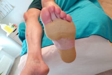Getapte voet van een wandelaar op de massagetafel