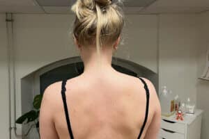 Vrouw met nekklachten bij Sport sneller in de massageruimte.